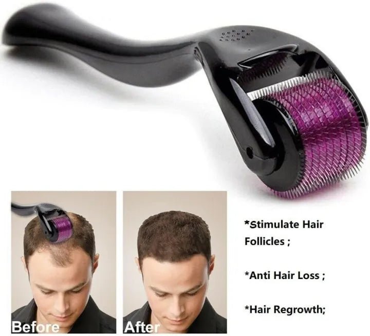 Derma Roller | Say Goodbye to Fine Lines & Hello to Smooth Skin