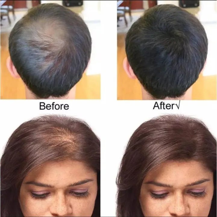 "King Hair Building Fibers 27.5g – Medium Brown | Premium Hair Thickening Solution