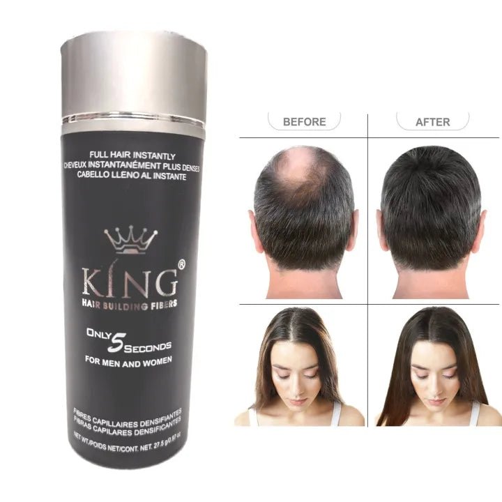 "King Hair Building Fibers 27.5g – Medium Brown | Premium Hair Thickening Solution